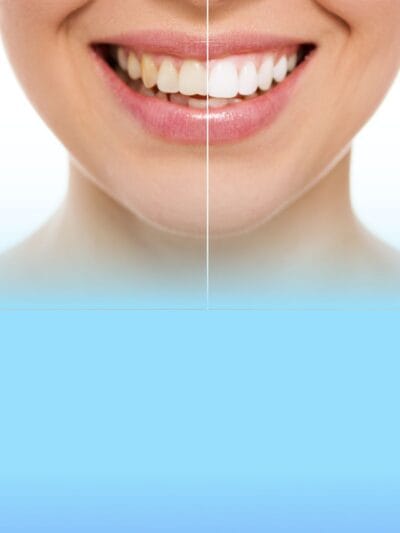 Igiena dentară